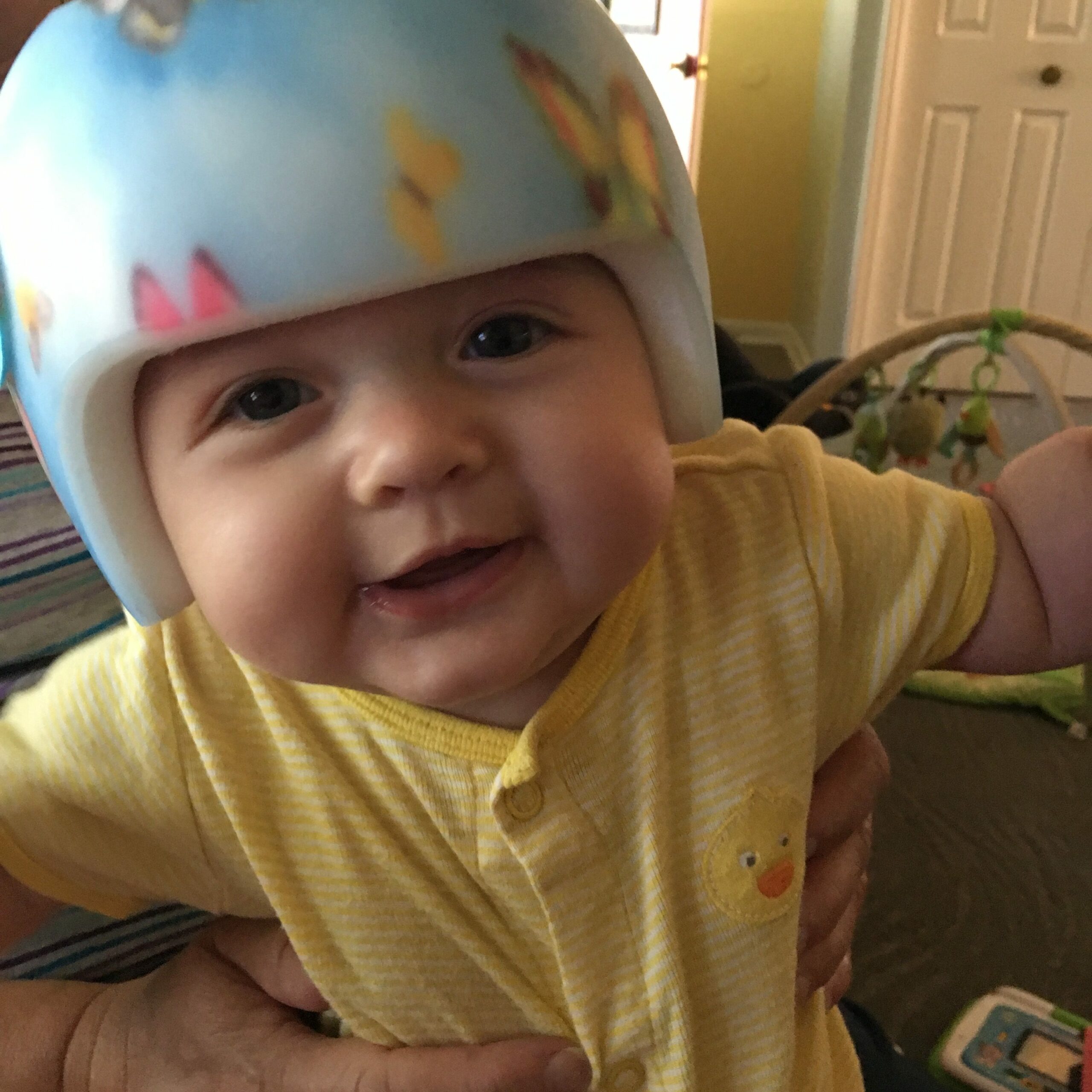 Anneliese's first day with her helmet